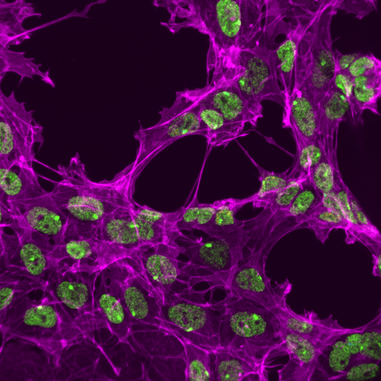 Why the X chromosome is a hotspot for disease-causing mutations